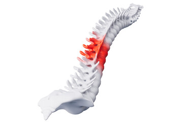 3d rendering medical spine injury