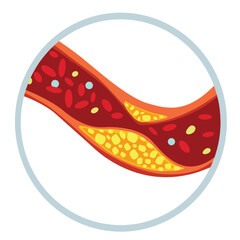 Cute cartoon hand drawn vector diagram of Cholesterol clipart.