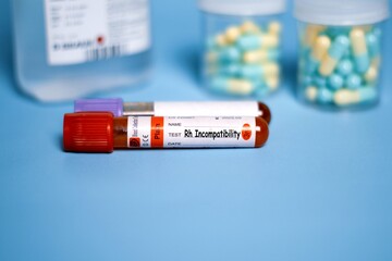 Rh Incompatibility - Test with a blood sample on a shiny blue background. Health or medical...
