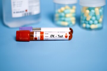 CPK - Test with a blood sample on a shiny blue background. Health or medical concept. Bekasi, Indonesia - July 14, 2025.