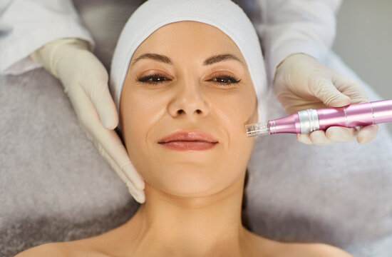 Cosmetologist, dermatologist beautician procedure, female face microneedling using dermapen for skin care, facial deep cleansing, skincare instrument professional treatments, happy woman enjoying