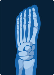 Foot and toy x-ray scan