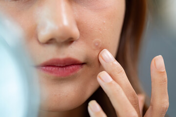 Skin Care Focus. Woman examining blemish on her face in the mirror.
