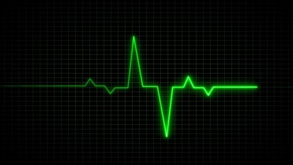 Green neon ekg heartbeat displayed on a monitor illustrating medical emergency and healthcare