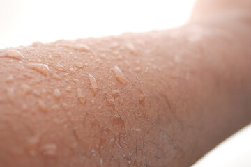 Close up of a wet arm shining in sunlight after swimming