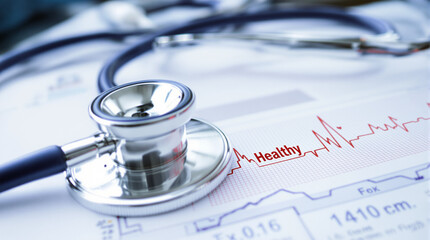 Stethoscope resting on medical charts displaying a healthy heart rhythm.