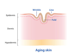 The line, wrinkle and fold on surface skin vector illustration. Cross section of aging skin that lose strength, flexibility and firmness on structure skin. Skin care and beauty concept. 