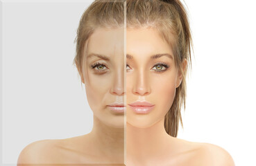 Signs of skin aging,signs of premature aging,
Wrinkles and fine lines,Age spots,Sagging...