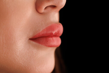 Aesthetic image of lips post-procedure, showing softness, color balance, and clean skin.