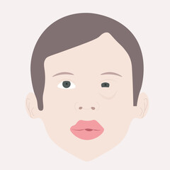 Flat vector illustrating anaphylaxis: swelling, rash, breathing trouble. Includes related allergies, asthma, and angioedema in clean, modern style. person