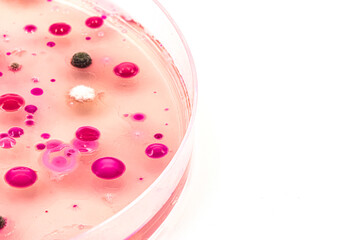 Microbiology. Laboratory Petri dish with black colonies of bacteria, yeast and fungi. Space for text.