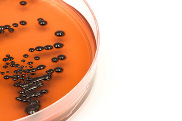Microbiology. Laboratory petri dish with black colonies of bacteria. Space for text.