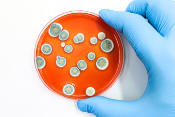Microbiological culture with a colonies of Fungi, mold.