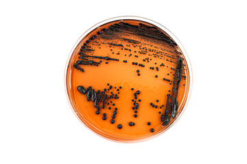 Microbiology. Laboratory petri dish with black colonies of bacteria. Space for text.