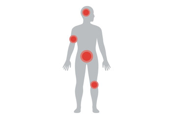 Pain localization chart with red circles on human body silhouette. Concept for headache, joint pain, muscular ache, stomachache. Medical vector illustration for health issues.