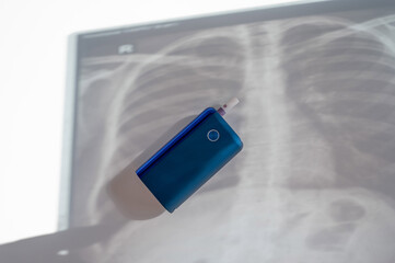 Electronic cigarette and lung x-ray. Tobacco heating system. 