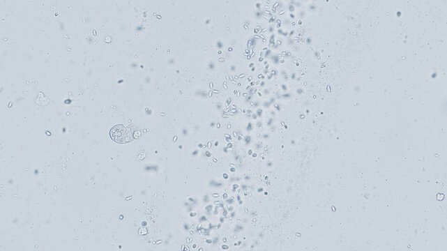 Paramecium and other single-cell organisms under microscope bright field view