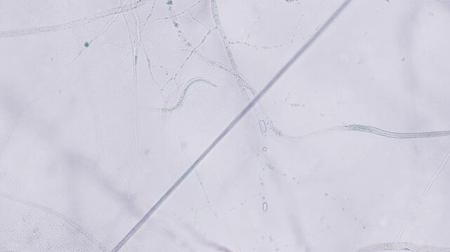 Nematode under microscope bright field view