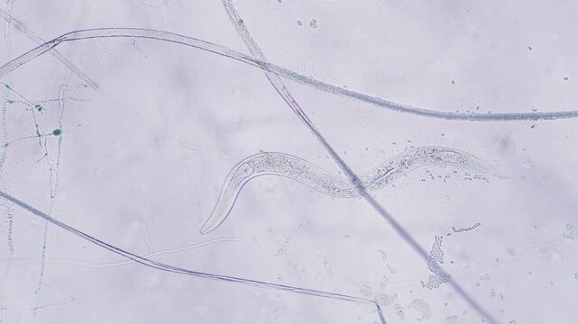 Nematode under microscope bright field view