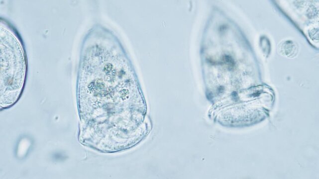 Bell-shaped ciliate vorticella under microscope in action