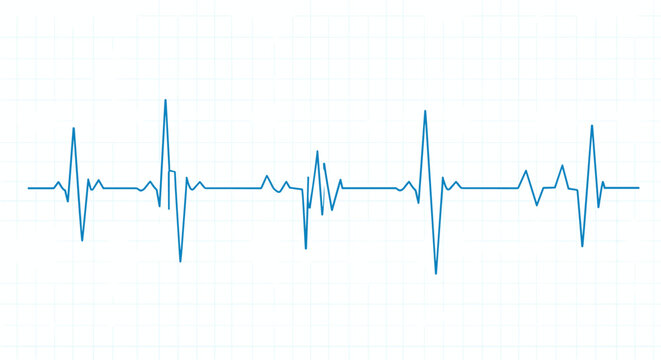 Heartbeat pulse line on graph paper background with blue ecg tracing