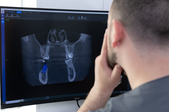 Dental Professional Analyzing 3D Cone Beam Computed Tomography Scan of Teeth and Jaw for Accurate Diagnosis and Treatment Planning in Modern Dentistry