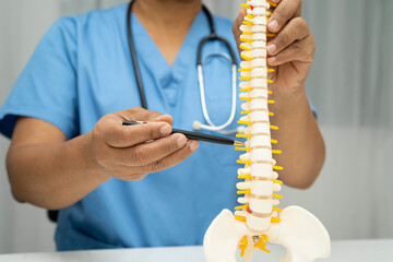 Asian doctor holding spinal nerve and bone model, Lumbar spine displaced herniated disc fragment for treatment medical in the orthopedic department.
