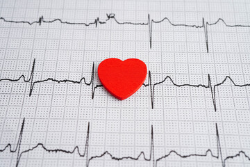 Electrocardiogram ECG, heart wave, heart attack, cardiogram report.