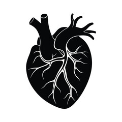Coronary Artery Blockage Medical Diagram