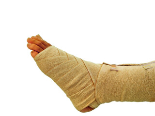 Close-up of sprained ankle showing swelling and compression bandage.