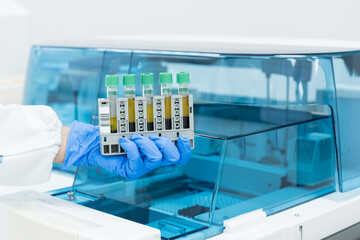 Close up scientist hand wear blue gloves holding blood test tubes with automatic machine in...