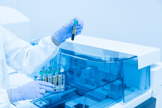 Close up scientist hand wear blue gloves holding blood test tubes with automatic machine in laboratory.Researcher analysis blood chemistry in medical laboratory. Medical healthcare technology research