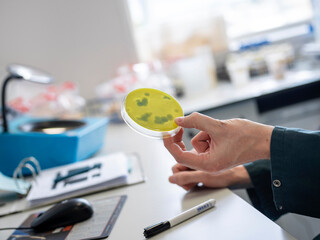 Hand holding yellow bacterial culture petri dish showing microbial colony growth for analysis