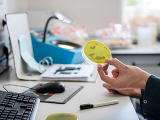 Scientist examining yellow culture medium petri dish with visible bacterial colonies in laboratory...