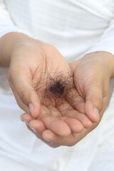 Hair loss in the center of the head or along the forehead