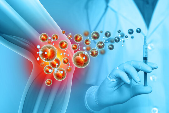 Injection into the knee joint. Platelet Rich Plasma for Knee Osteoarthritis. 3d illustration