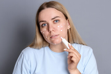Woman applying cream onto face on grey background. Acne treatment