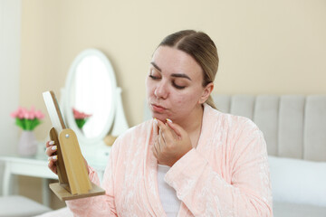 Woman with acne problem looking in mirror at home