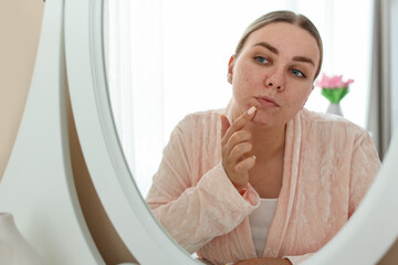 Woman with acne problem looking in mirror at home