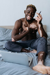 Positive and shirtless african american man with vitiligo holding pen near laptop on bed