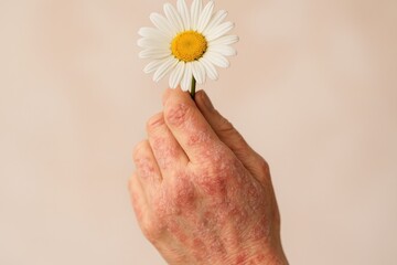 A close-up of an elderly hand holding a white daisy flower. The hand shows visible signs of aging with wrinkles and age spots. The background is soft and neutral.