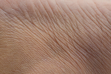 Macroscopic human skin texture,Macro texture of dry human skin, dehydrated epidermis closeup view,...