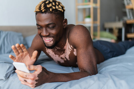 Cheerful african american man with vitiligo having video call on smartphone on bed