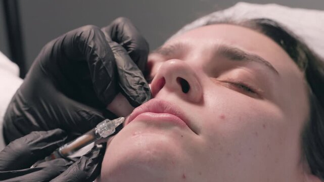 This is a detailed closeup view that showcases a cosmetic lip enhancement procedure which utilizes dermal fillers