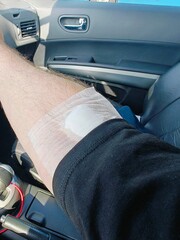Arm with bandage visible in car interior during sunny day in urban area after minor injury was treated