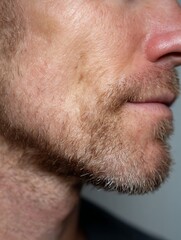 Obraz premium Focus on the man's skin after shaving, with small red spots and slight irritation. Suitable for advertising after-shave or soothing gel.