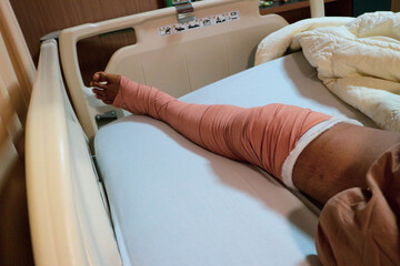 a man's leg wrapped in a bandage after surgery