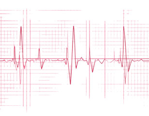 ECG Heartbeat Tracing on Graph Paper with Regular Sinus Rhythm, Isolated on Transparent Background PNG