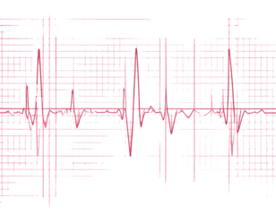 ECG Heartbeat Tracing on Graph Paper with Regular Sinus Rhythm, Isolated on Transparent Background PNG