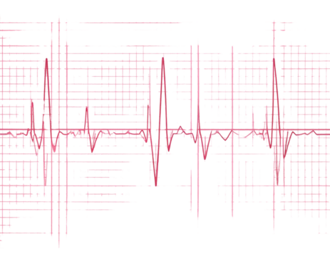 ECG Heartbeat Tracing on Graph Paper with Regular Sinus Rhythm, Isolated on Transparent Background PNG - Powered by Adobe